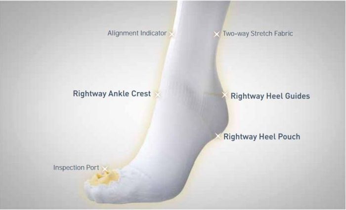Anti Embolism Stockings- Knee (Alpha)